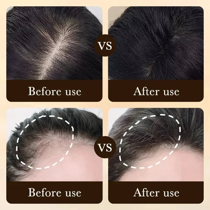 שמן לגידול שיער מהיר Biotin מוצרים לטיפוח הקרקפת טיפוח טיפוח טיפוח נגד הפסד שיער יעיל גידול שיער עבה סרום לגברים - תמונה 2