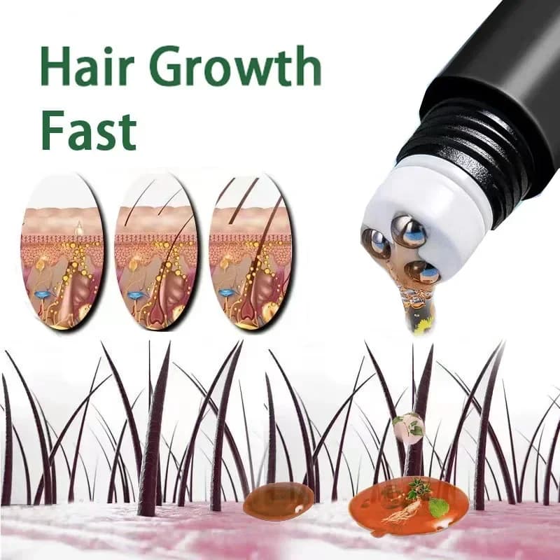 שמן לגידול שיער מהיר Biotin מוצרים לטיפוח הקרקפת טיפוח טיפוח טיפוח נגד הפסד שיער יעיל גידול שיער עבה סרום לגברים